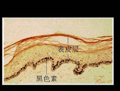 黑色素如何炼成的,黑色素怎么生成详细解说