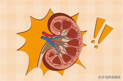 尿酸高对肾功能有哪些影响,尿酸高影响肾怎么治疗