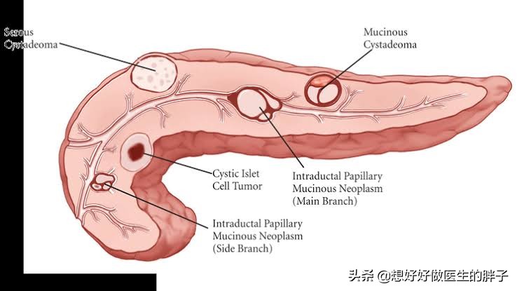 经常觉得右上腹胀,右上腹隐痛有哪些原因和治疗方法