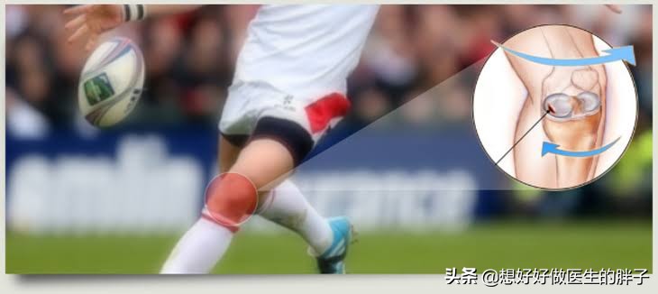 为什么足球运动员不会半月板受伤,足球运动半月板损伤