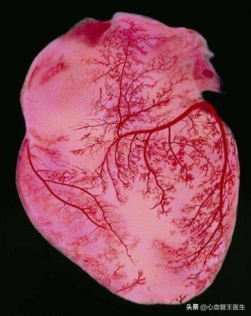 心脏血管狭窄25%最好的治疗方法,心脏血管狭窄30%以后会不会更严重