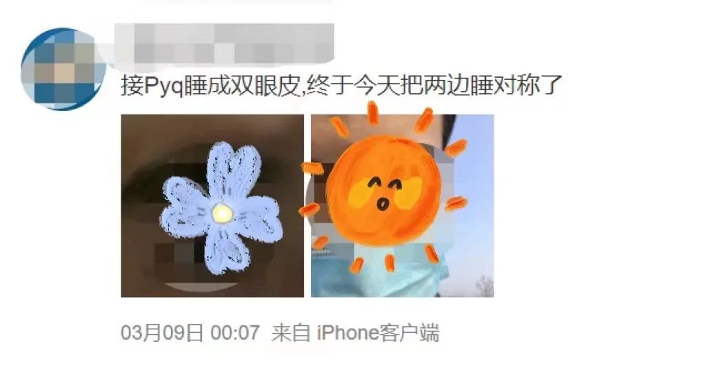 一觉醒来变成单眼皮是什么原因,一觉醒来眼皮一单一双是怎么回事