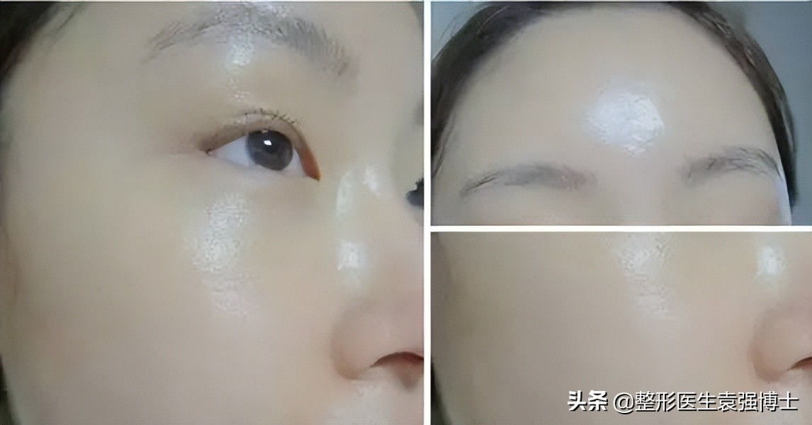 50岁女人看起来像三十岁吗,女人40岁应该做的医美项目