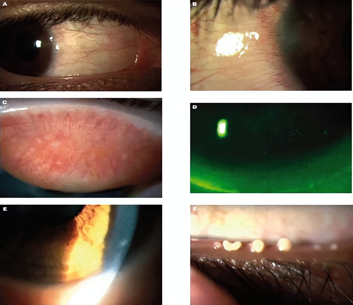 ≥99.99%冠状病毒灭活率！3N角膜接触镜护理仪或是新希望