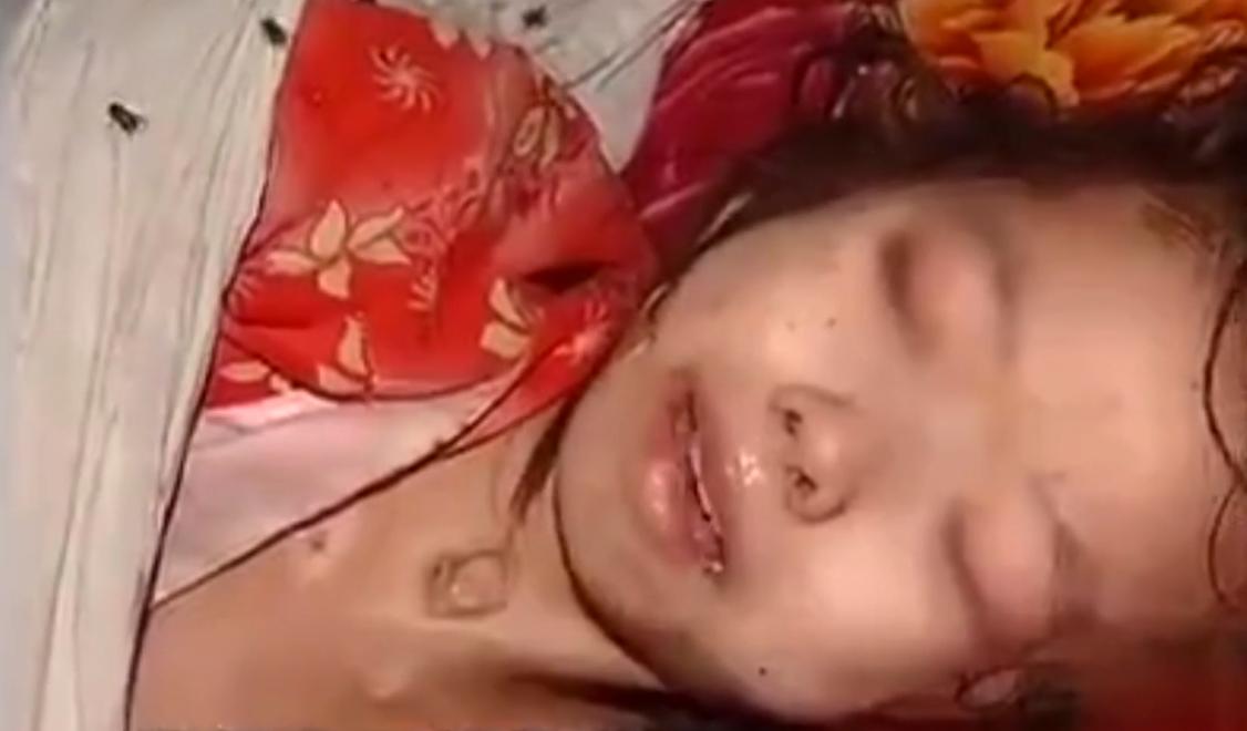 四川10岁女孩生命垂危,四川十岁女孩身体溃烂父母辟谣