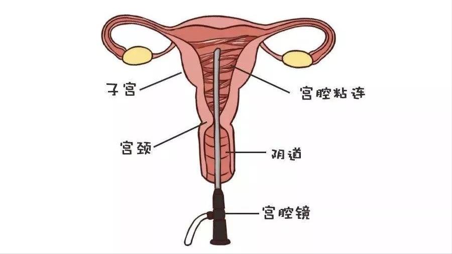 闭经指的是多长时间不来月经,月经一直正常突然闭经是什么原因