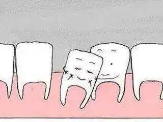 牙齿一吃东西就酸痛,一个牙齿一吃东西就痛是什么原因