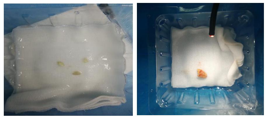 徐州市儿童医院呼吸二科,儿童呼吸介入科的设备