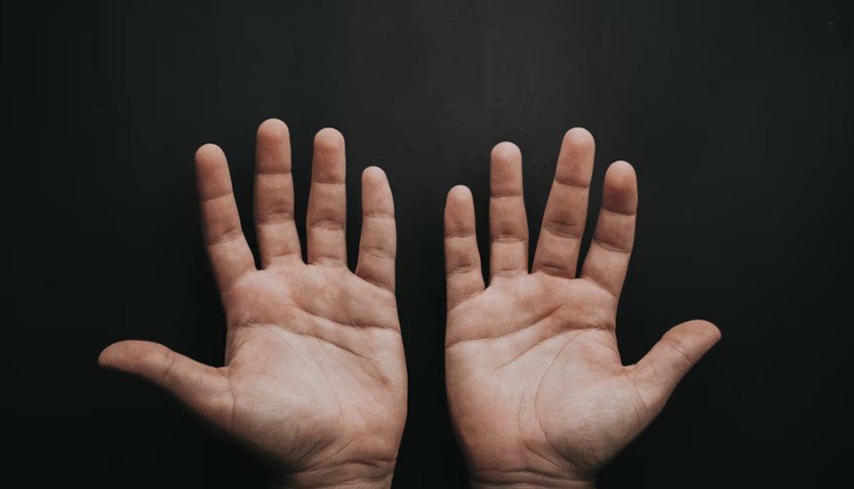 天生没有指纹的人是怎么回事,天生无指纹的人