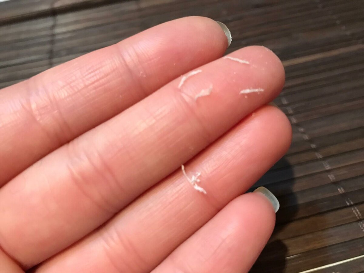 指甲有凹凸的波浪纹是什么原因,指甲渐变有条纹怎么解决