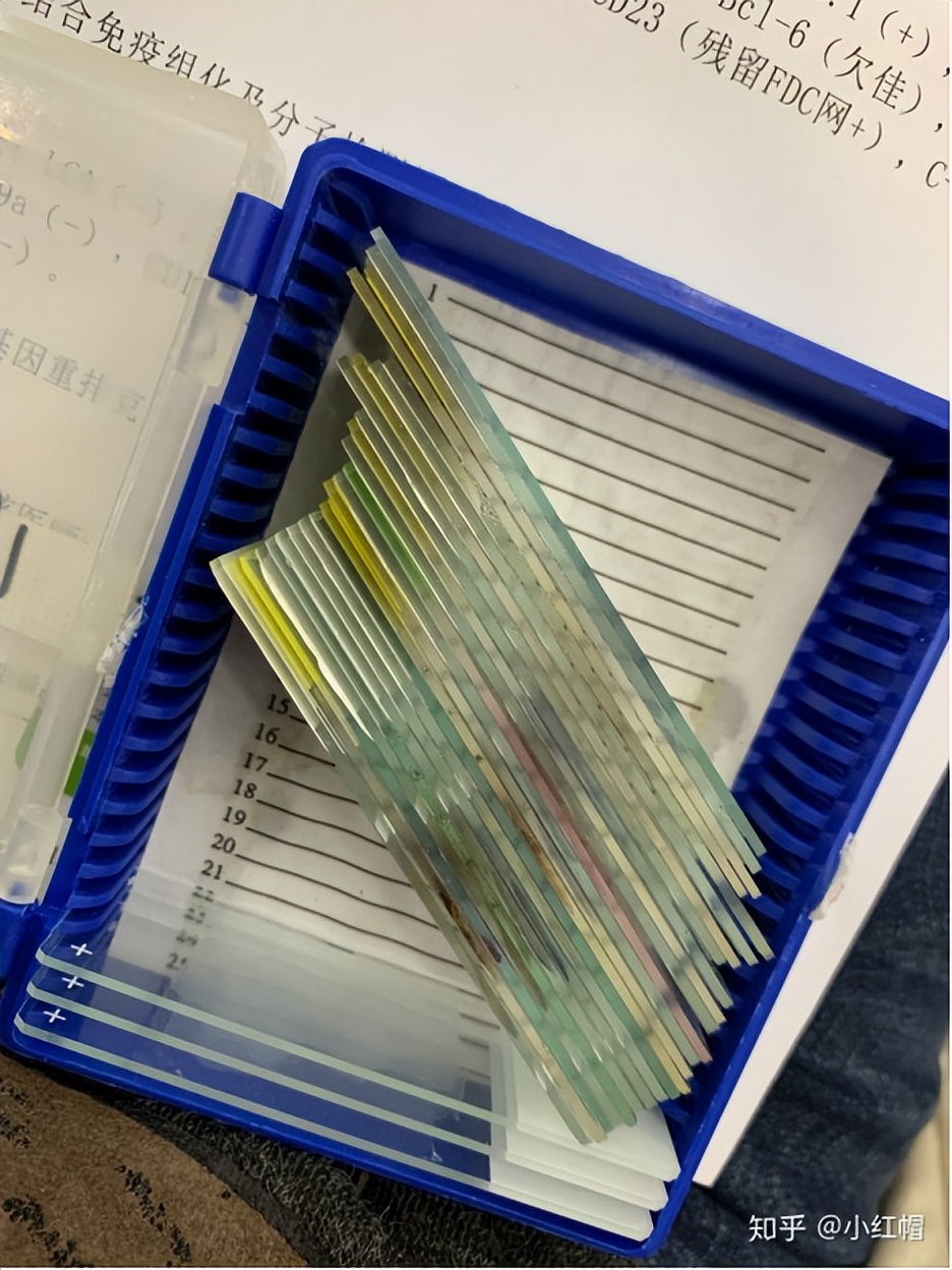 最可怕的癌症复发方式,癌症复发恐惧