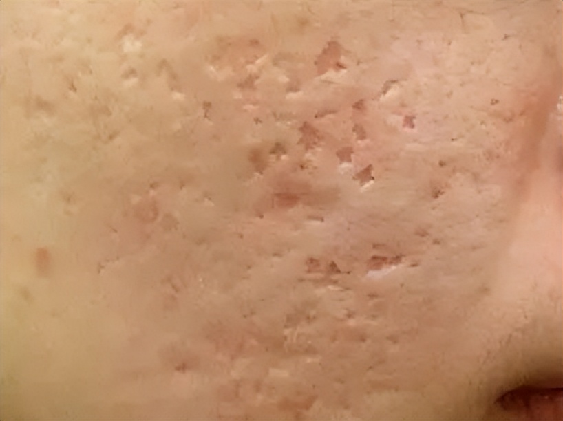 养成干净脸的最好方法,养成干净脸