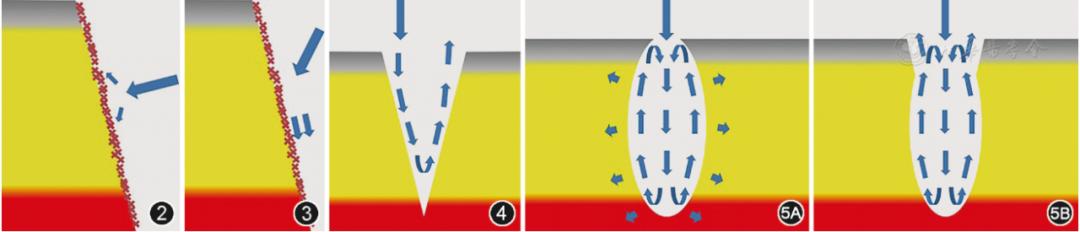 急诊清创缝合术操作流程,急诊清创缝合术后的护理措施