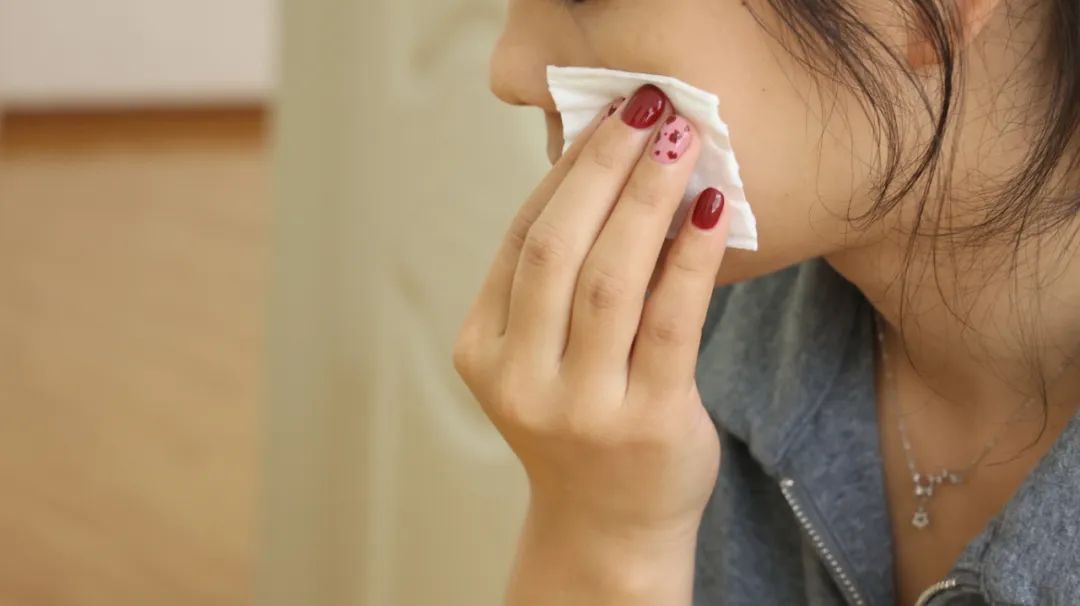 脸部总是干燥起皮怎么办,脸部干燥爆皮用什么修复