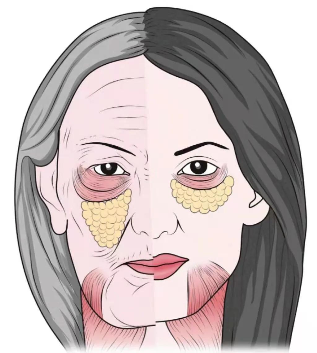 眼袋形成的原因及解决,眼袋形成原理