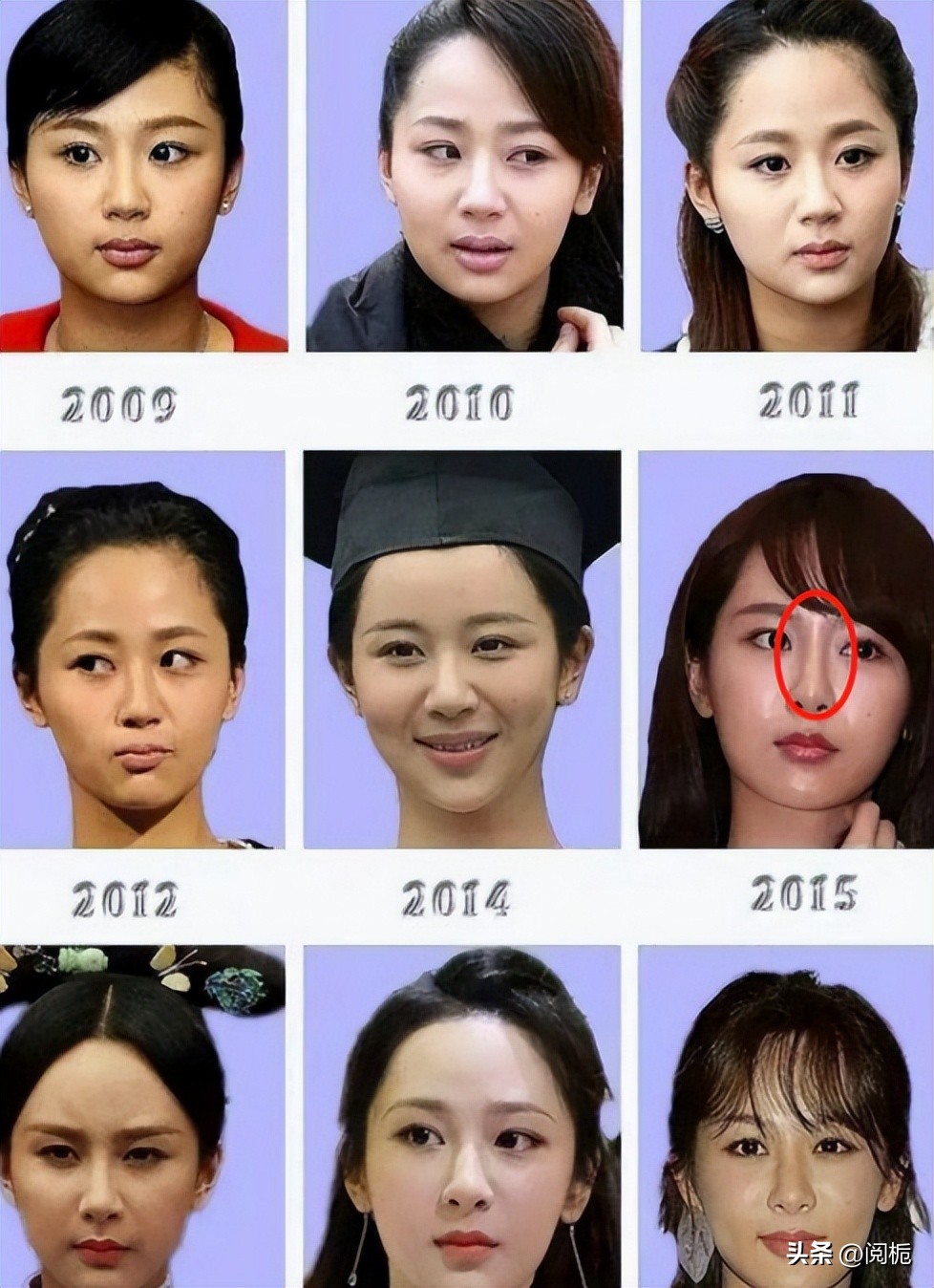 靠换脸逆天改命的六位女星,长得歪瓜裂枣整得美若天仙的明星