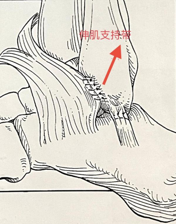 踝关节韧带损伤病历模板,踝关节外侧韧带损伤发病原因