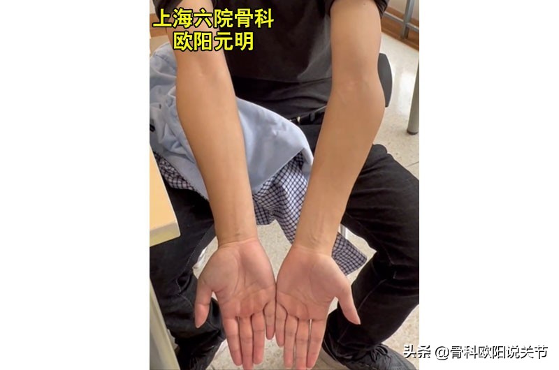 名医讲述滑膜炎,名医专访骨科医生