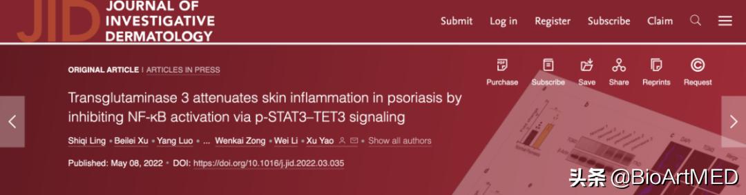 姚煦团队揭示转谷氨酰胺酶3在银屑病皮肤炎症中的表观调控机制