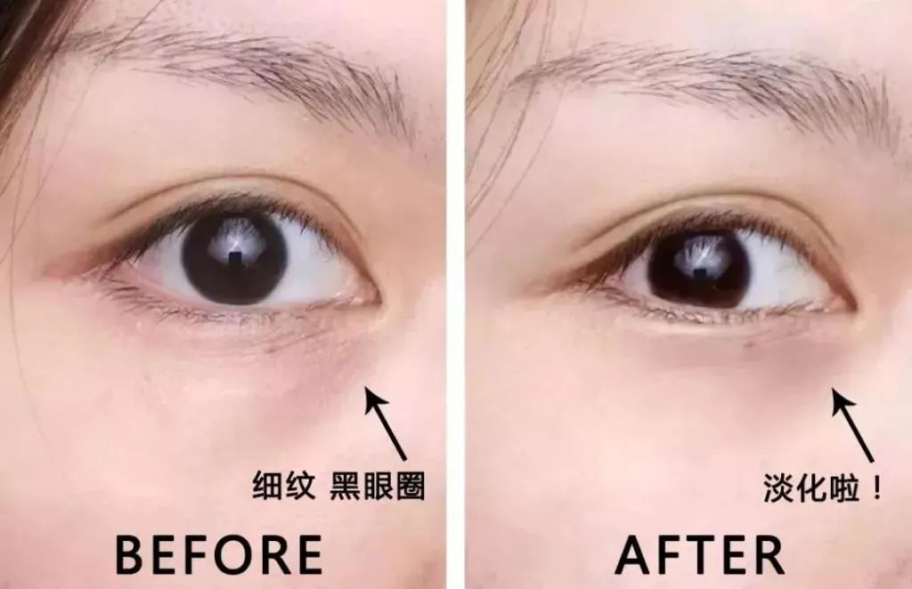 新款兰蔻小黑瓶眼霜里面有细闪吗,兰蔻菁纯淡纹黑眼圈眼霜