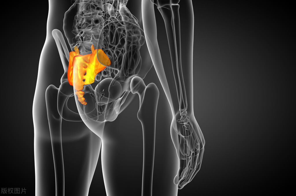 骶管囊肿做什么检查,查出骶管囊肿后尾骨胀