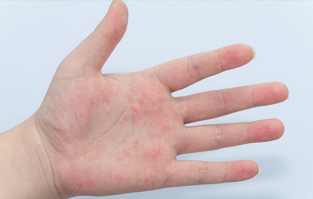 阴阳两虚怎么调理对肝,肝肾阴阳两虚青少年怎么调理