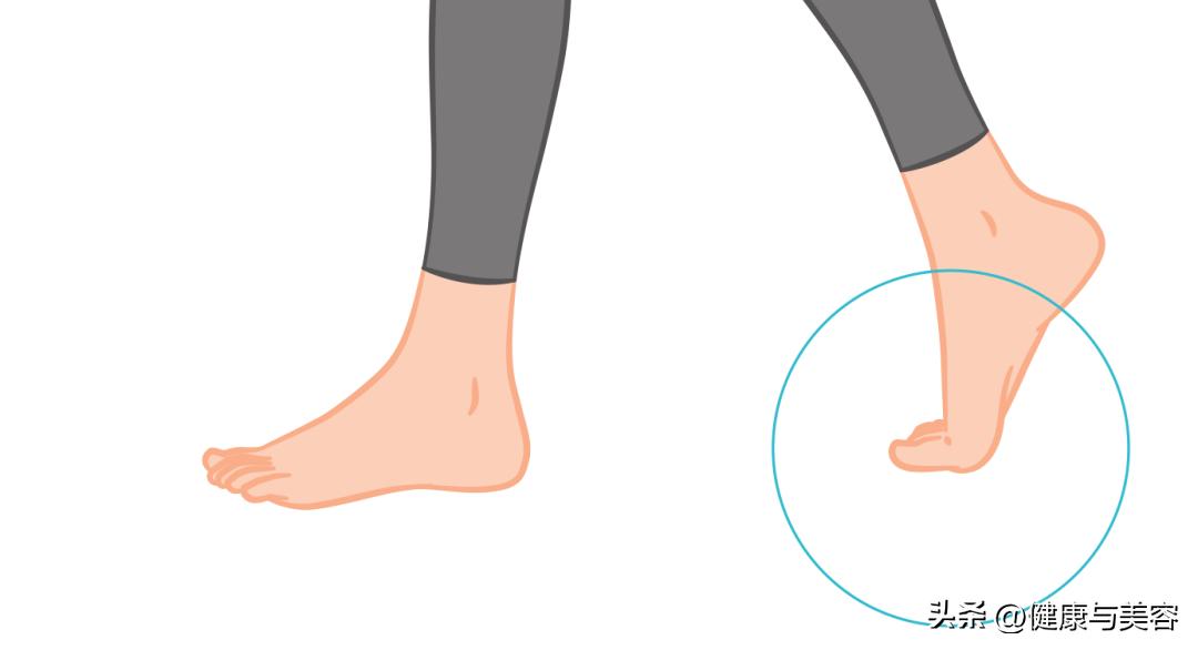 指甲卷曲内卷,指甲卷曲用什么药