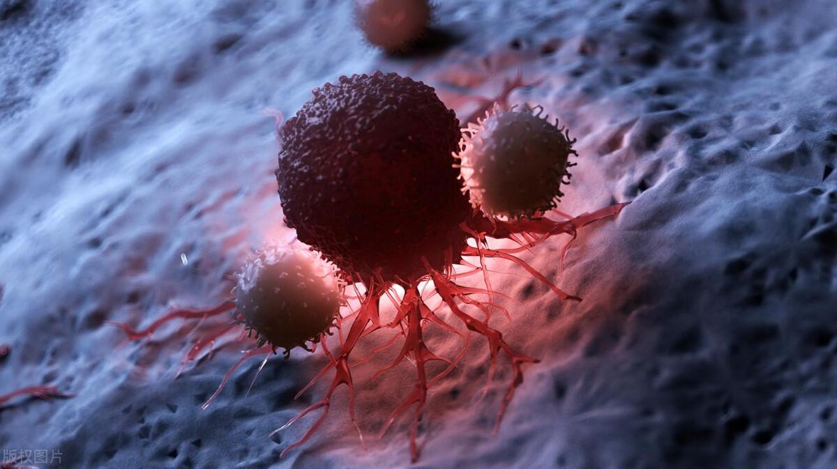 中医治疗恶性肿瘤，实现带瘤生存，有效缓解放化疗痛苦