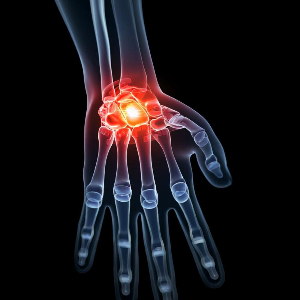 手腕骨折与桡骨远端骨折哪样严重,老年人手桡骨骨折多久能恢复