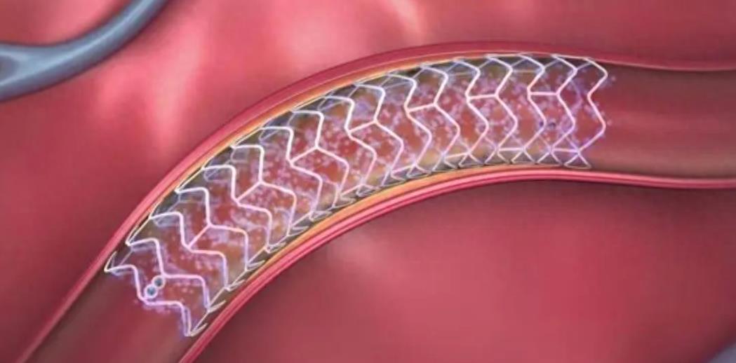 使用近红外荧光成像，进行生物功能性可降解支架的无创监测工程