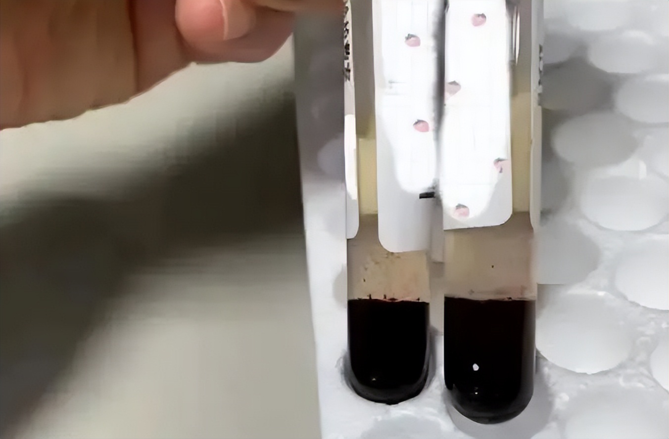 产妇大出血经历,产妇34天后出血