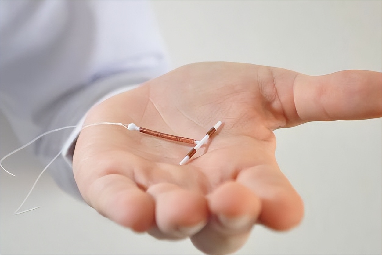 节育环在女性体内会发生什么变化？30年前上环的女性，有哪些结局