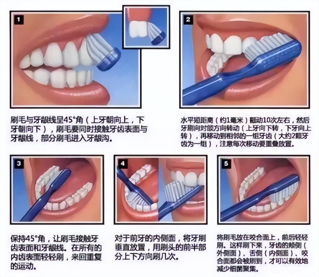 医用漱口水真的可以去除口臭吗,一次性漱口水杀菌除口臭怎么用