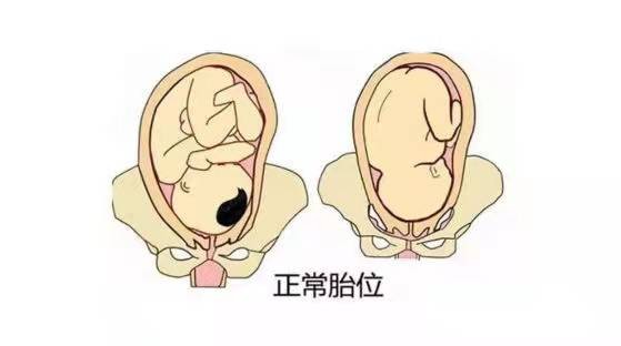 孕妈日记119,36周头位37周变臀位了怎么办