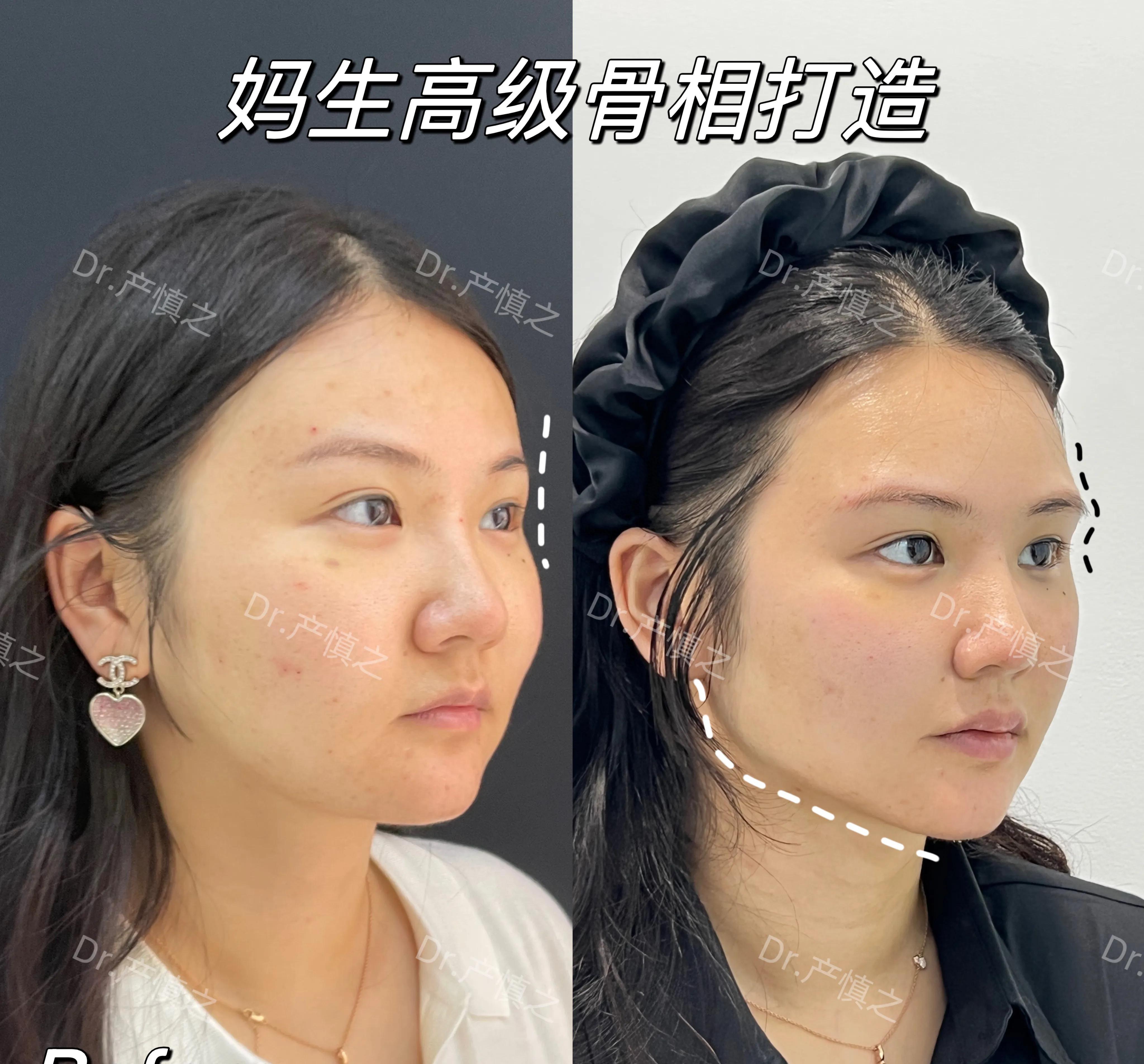 女明星集体回春做了什么医美,女明星集体回春