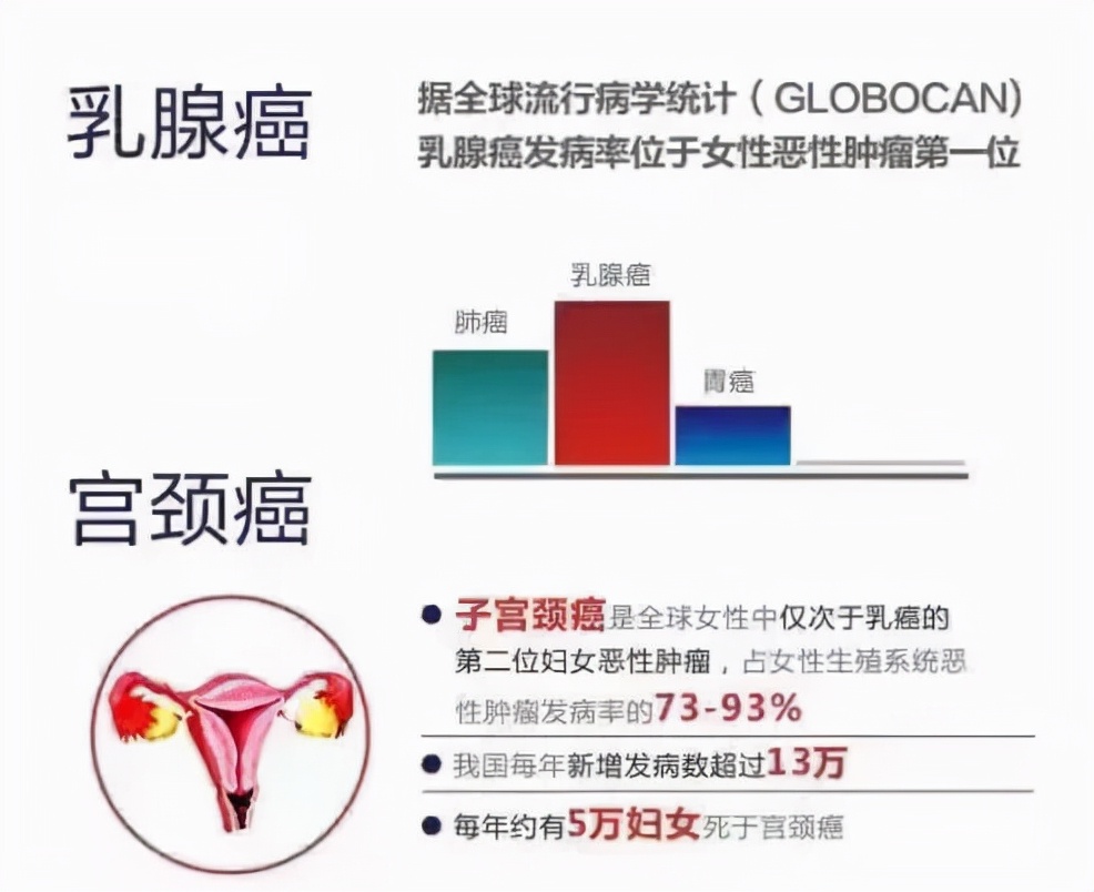 庆城县2022年为民办实事“两癌”免费检查开始啦