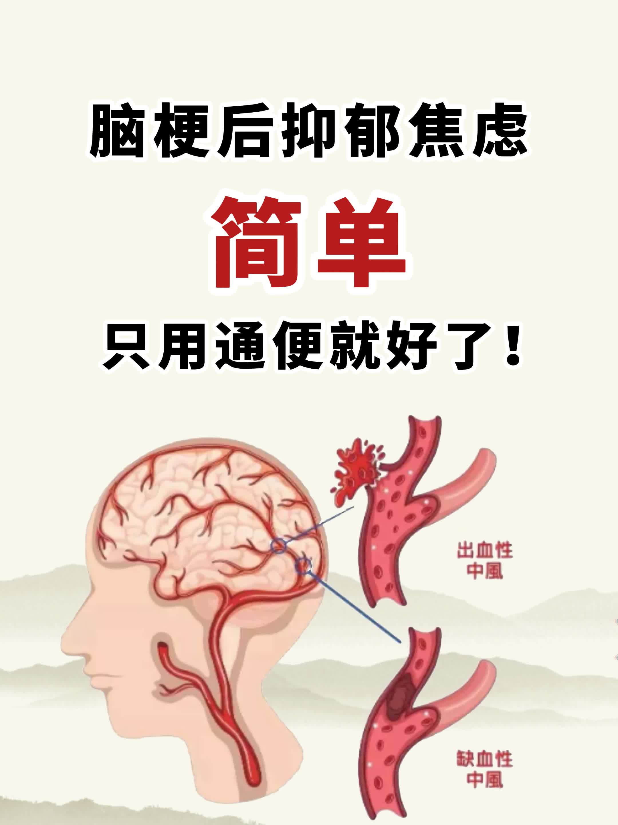 脑梗后抑郁焦虑，简单，只用通便就好了！