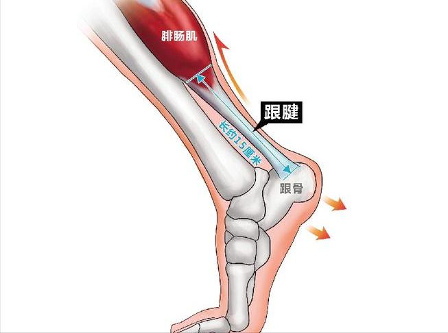 跟腱断裂的概率,跟腱断裂的球员有哪些