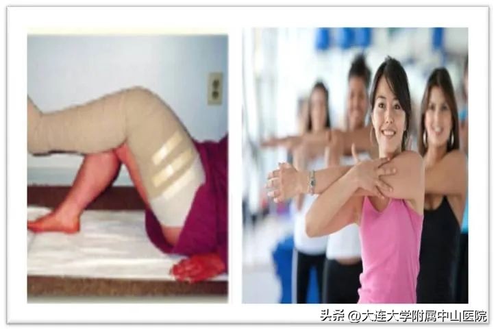 淋巴清扫后水肿怎么治疗可以康复,腋窝淋巴清扫后腋窝水肿处理方法