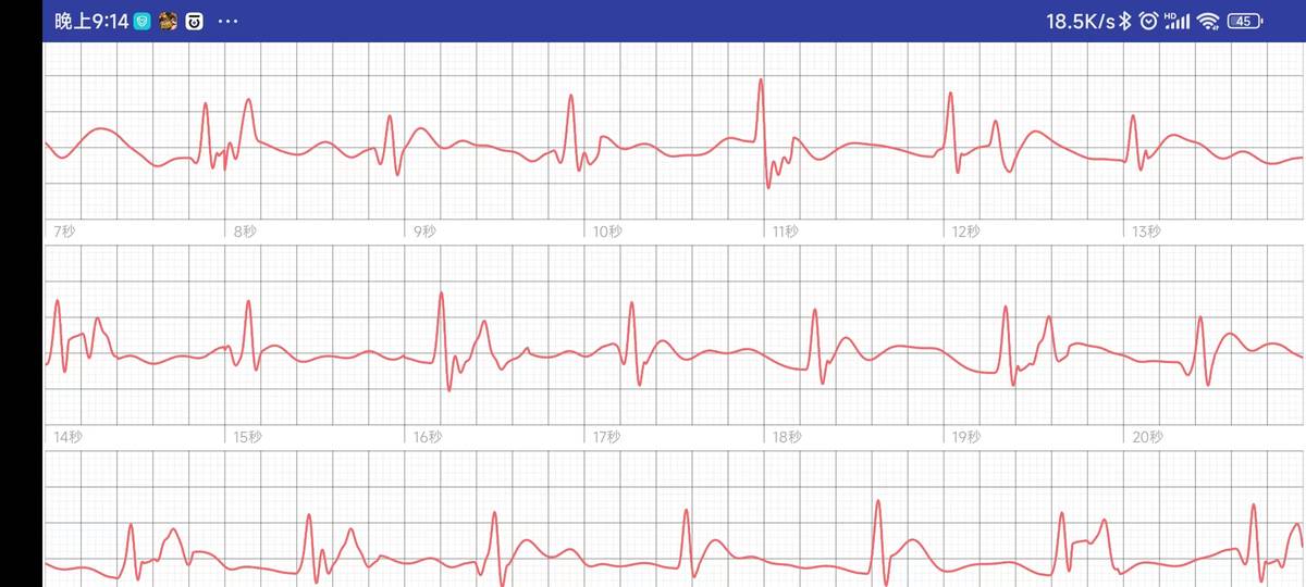 精准实时测心率和血压的智能手环,智能手环血压心率测量戴哪只手好