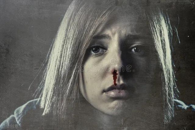 足球运动员颅脑损伤,足球运动员会不会脑震荡