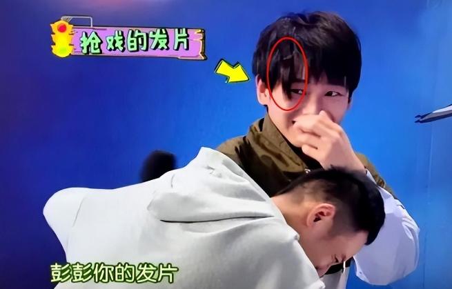 明星逃不过的脱发,明星也秃头还戴假发片