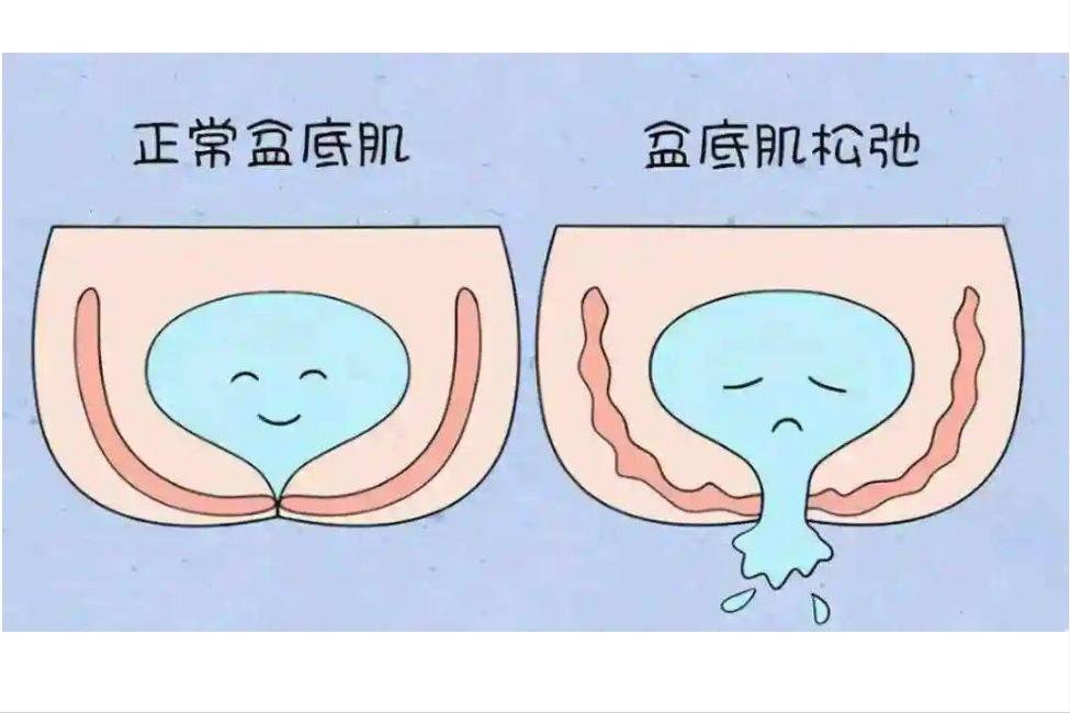 剖腹产后多长时间可以同房？过早*生活性**有什么风险？进来告诉你