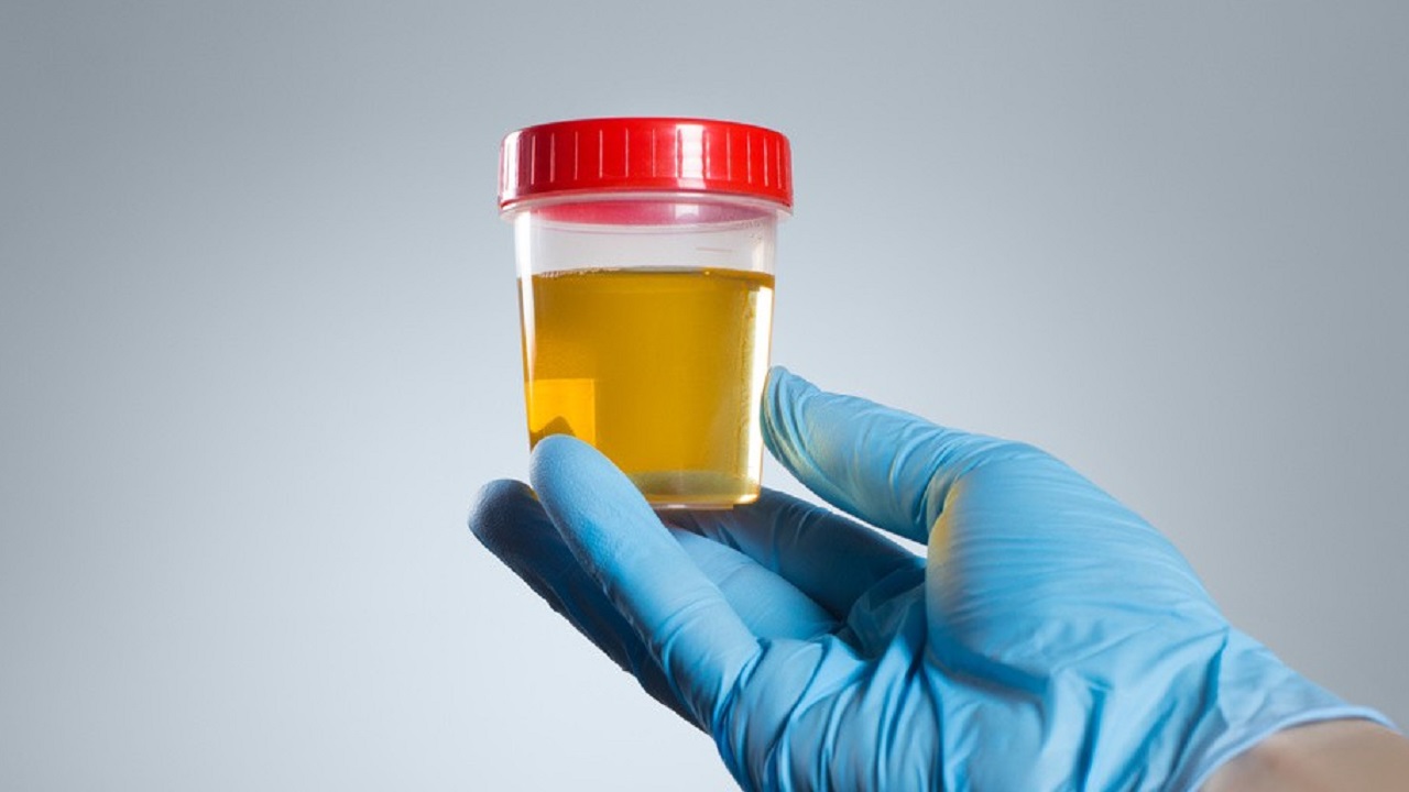 腰不疼尿血怎么回事,腰有点痛出现血尿是什么原因