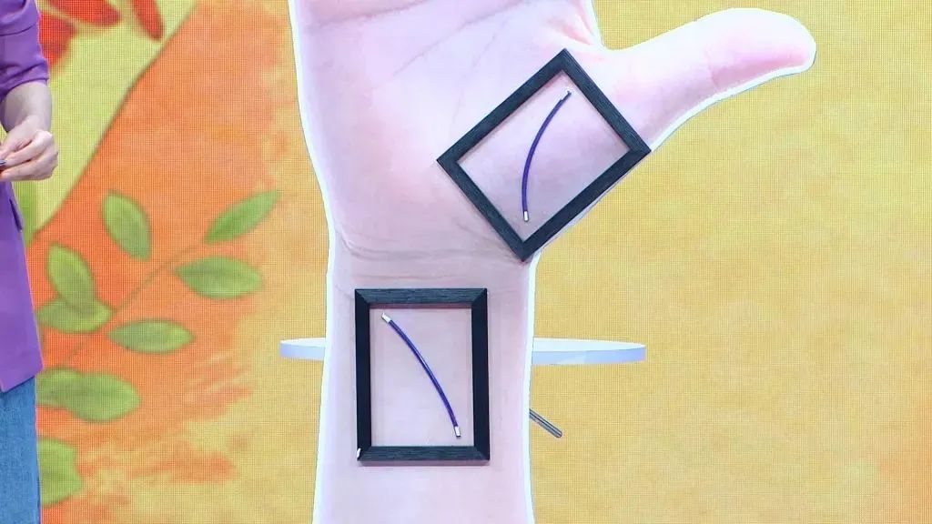 手脚血管突然明显凸起,心脏血管三高怎么预防