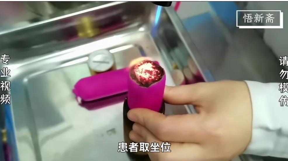 雷火灸治鼻炎怎么操作,雷火灸鼻炎灸视频