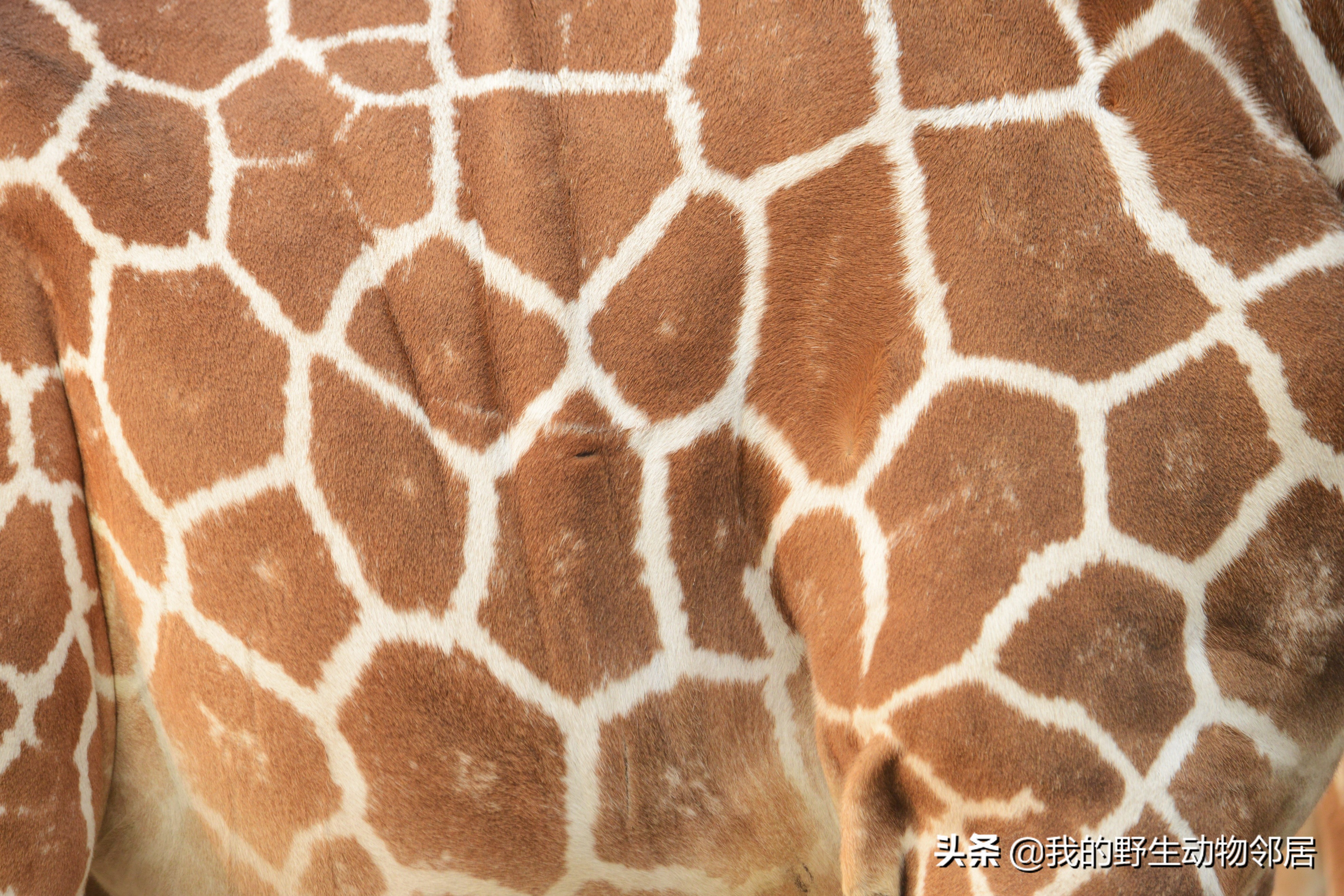 脖子长头发是怎么回事,脖子长淋巴结怎么办