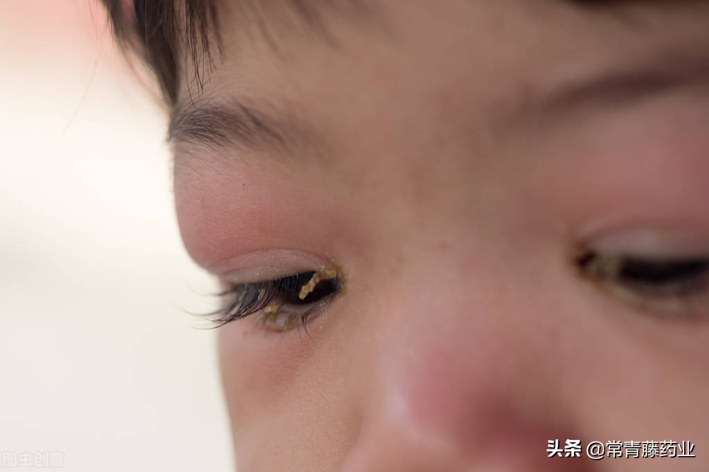 疱疹病毒性角膜炎是怎么引起的,眼睛感染有水泡