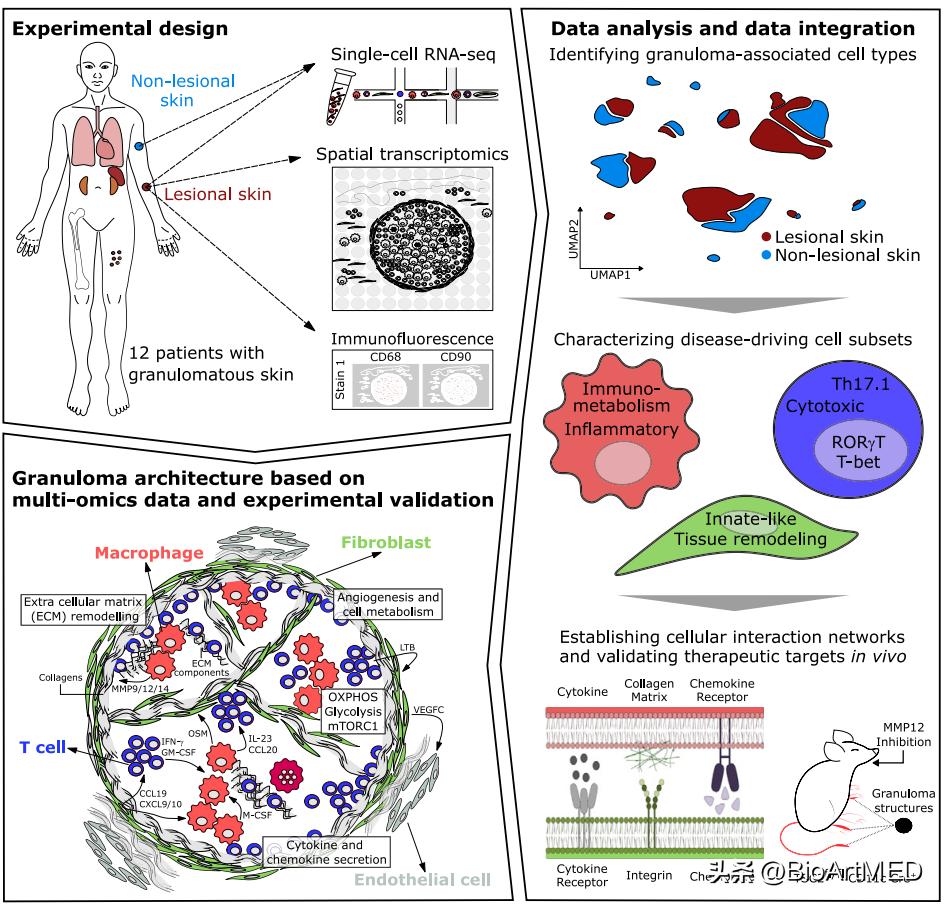 淋巴非干酪性肉芽肿,颈部淋巴肉芽肿性炎