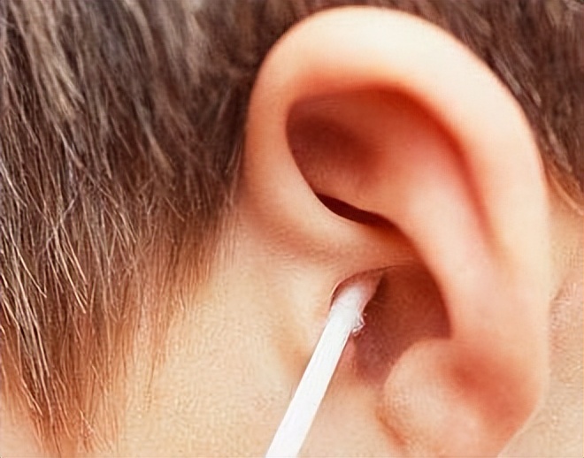 为什么有的人是油耳,糠耳与油耳的区别